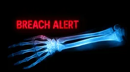 Healthcare Firm Handing up to $5,000 to Victims After Hack Exposed Full Names, Social Security Numbers, Bank Account Info and Confidential Medical Details